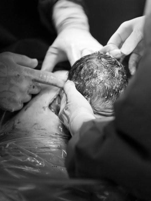 img-obstetricia-14-002